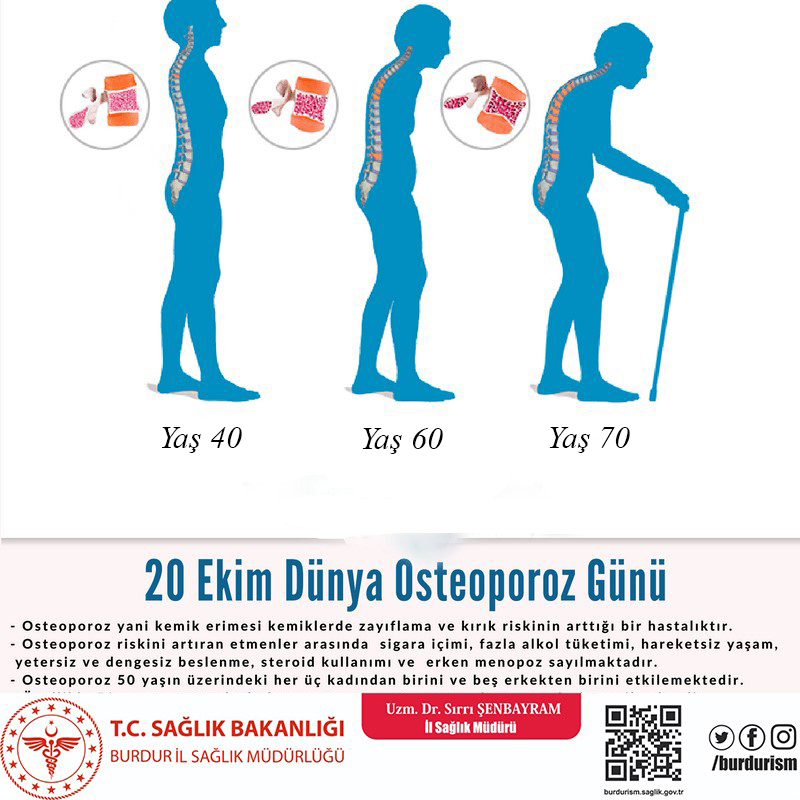 osteoporoz-DSN-doktorlarsitesi.jpg